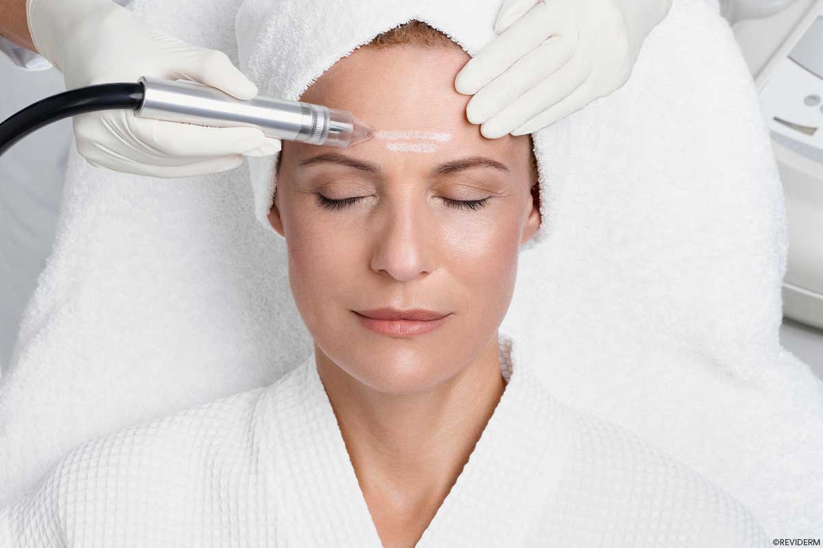 mikrodermabrasion my beauty spa
